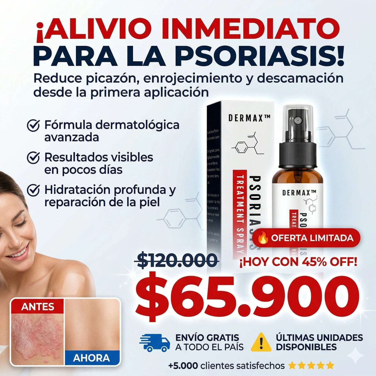 Spray Psoriasis